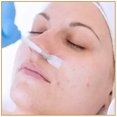 Chemical Peels Treatment