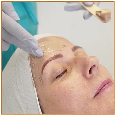 Cosmelon Peel Treatment