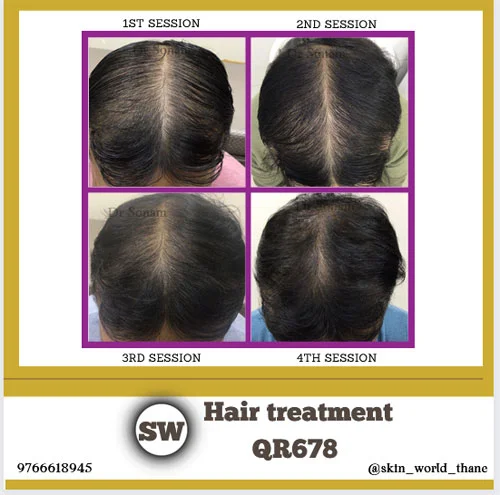 Hair Treatment QR678